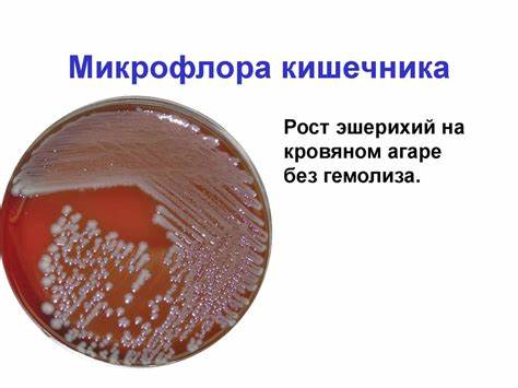 Диета и микрофлора кишечника Микрофлора тела человека - презентация онлайн Микрофлора тела человека - презентация онлайн Диета и микрофлора кишечника