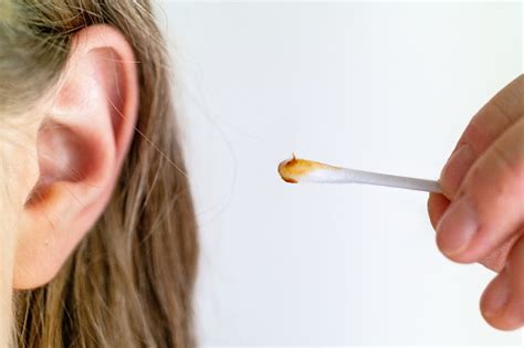 Dirty Brown Ear Wax Cotton Swab Stick Held Between Fingers By Young