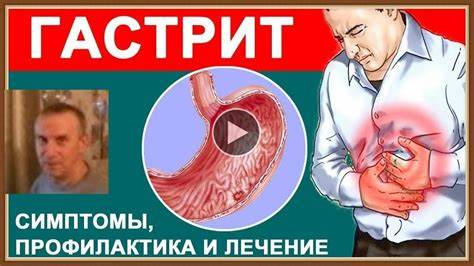 ГАСТРИТ - СИМПТОМЫ ЛЕЧЕНИЕ НАРОДНЫМИ СРЕДСТВАМИ - YouTube Картинка - ГАСТРИТ - СИМПТОМЫ ЛЕЧЕНИЕ НАРОДНЫМИ СРЕДСТВАМИ - YouTube