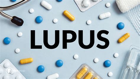 Sistemski Eritemski Lupus 5 Najčešćih Simptoma