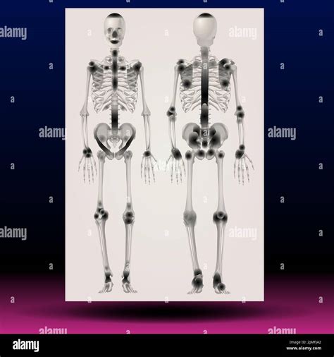 X Ray Illustration Of A Human Skeleton Stock Photo Alamy