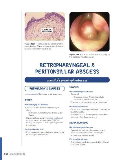 Retropharyngeal And Peritonsillar Abscesses Osmosis