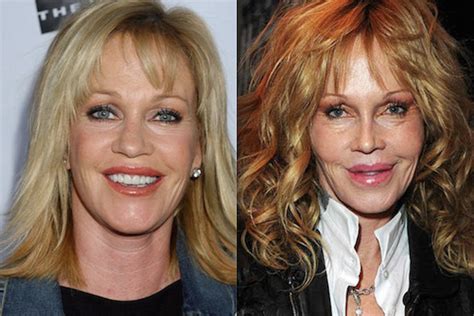 10 famous actresses who are unrecognizable after plastic surgery mandatory