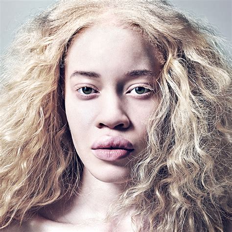 Albino Models And Black Women Hairstyles Hairstyles 2017 Hair Colors