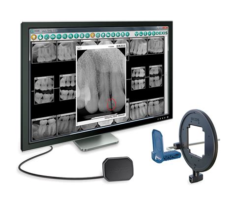 Dexis Platinum Digital Imaging System November 2016 Inside Dentistry