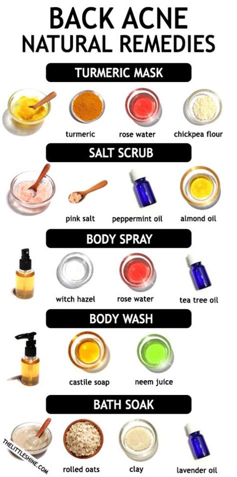 Back Acne Remedies The Little Shine