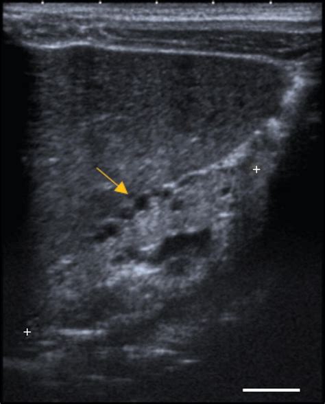 Longitudinal Image Of Renal Ultrasound Scan Performed At Months Of Download Scientific