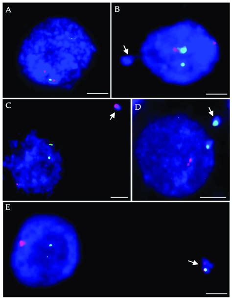 B Distachyon Interphase Nuclei Control A And With Micronuclei Mn