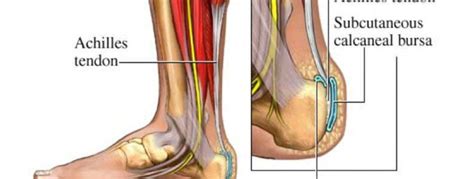 The good news is extensor tendonitis recovery time can be greatly shortened if you follow the right procedure. Faster Recovery from Achilles Tendon Issues: Florida ...