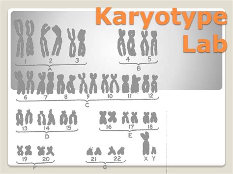 Ppt Karyotype Lab Powerpoint Presentation Free Download Id7051272