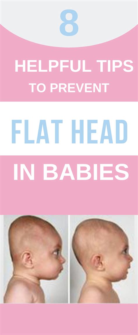 8 Helpful Tips To Prevent Flat Head In Babies Flat Head Baby Health