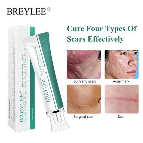 New 30g Acne Scar Removal Cream Skin Repair Face Cream Acne Spots Acne
