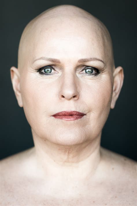 7 Stunning Portraits Of Women With Alopecia Redefine Femininity Huffpost