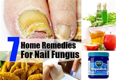 Home Remedies For Nail Fungus Headtotoebeautyroutine Nail Fungus