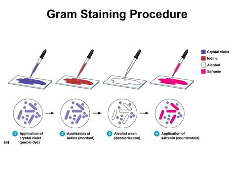 Gram Staining Well Explained Updated Laboratory Insider Medical