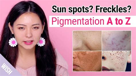 Freckles Sun Spots Pigmentation Meaning And How To Prevent And Fade
