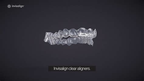 Others tips for making braces more affordable Invisalign First | Houston Orthodontics & Invisalign - YouTube