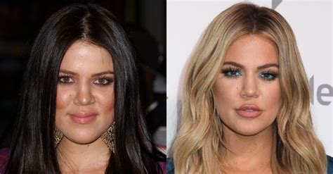Khloe Kardashian Gets Honest About Surgery Rumours ...