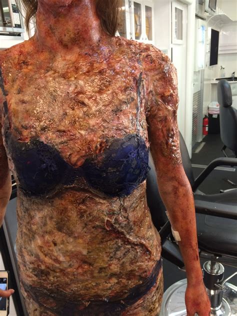 But taking part has been transformative for me: Code Black Burned Body Prosthetics - Vincent Van Dyke Effects