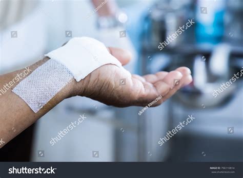 Womans Hand Cover Wounds On Hands Stock Photo 796110814 Shutterstock