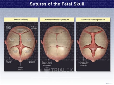 Sutures Of The Fetal Skull Trialexhibits Inc