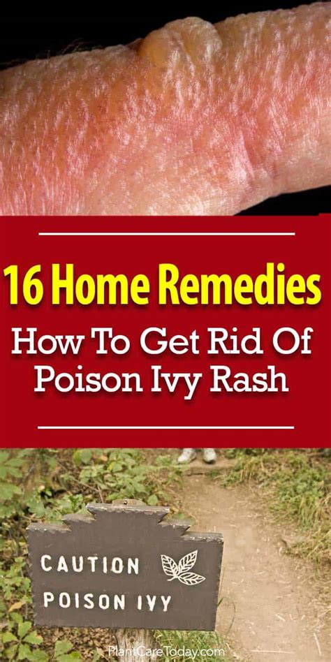 How To Prevent And Treat Poison Ivy Oak And Sumac Poison Ivy Kill