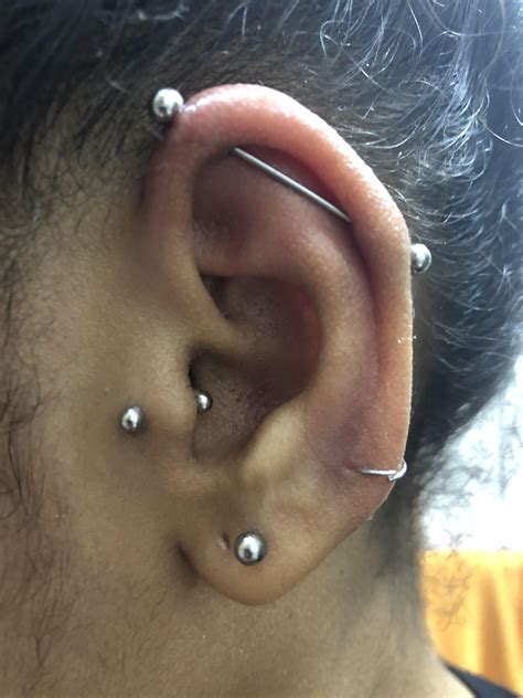 Swollen And Possibly Infected Industrial And Tragus Piercing 1 Week Old Stainless Steel