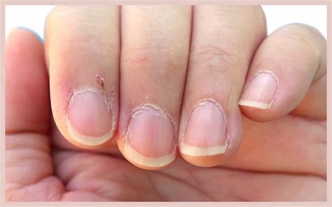 What Do Cuticles Say About Your Health Elim Spa Products