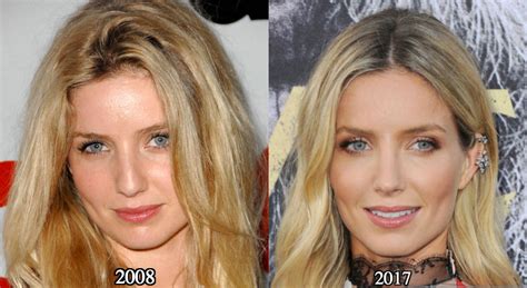Annabelle Wallis Nose Job Plastic Surgery Before And After Photos