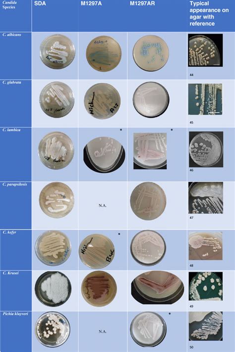 Different Candida Spp Colony Morphology On Various Agar Media Na