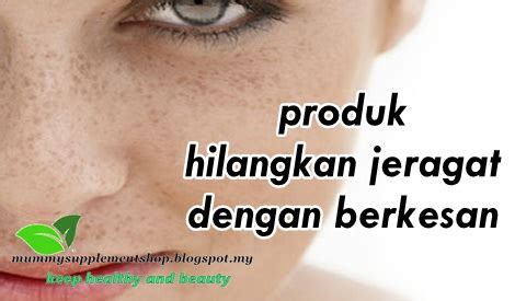 Kamu juga bisa menambahkan beberapa tetes madu untuk hasil yang lebih baik. 4 PRODUK UNTUK HILANGKAN JERAGAT DENGAN BERKESAN - BLOG ...