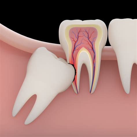 Tooth Extractions Kenilworth Il Glenview Il Evanston Il