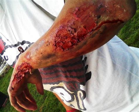 A common injury if you are thrown off your motorcycle is road rash. Road Rash (Makeup) by ShirubaKitsune on DeviantArt