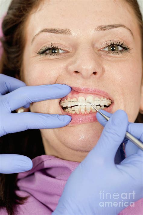 Orthodontist Tightening Braces Photograph By Microgen Images Science Photo Library Pixels