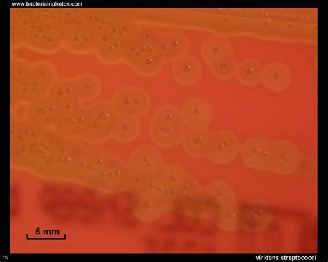 Streptococcus Viridans Heart Valves