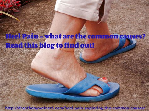 Pin On Women And Foot Pain