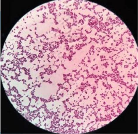 Bacteria, disease, escherichia coli, pathogens, microscopy. Morphological view of Lactococcus culture under microscope ...