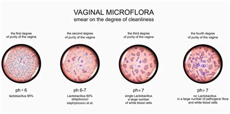 Gardnerella Vaginalis The Definitive Guide Biology Dictionary