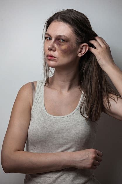 Premium Photo Domestic Violence Abuse Woman With Bruise On The Face