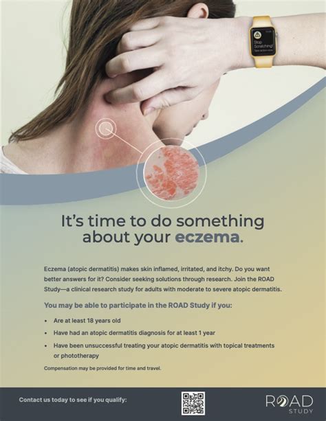 Do You Call It Eczema Or Dermatitis We Do Research And Diagnose And