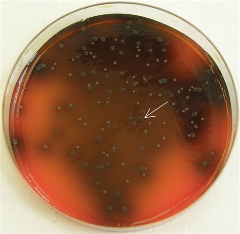 Outsourcing activities under 'closing gaps for performing a risk assessment on l. PALCAM agar