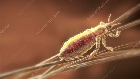 Head Louse Artwork Stock Image C0218481 Science Photo Library