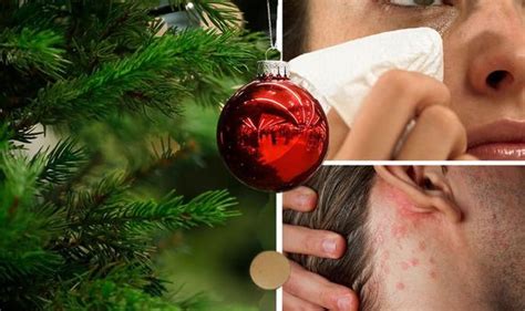 Christmas Tree Syndrome Do You Have It Six Symptoms To Watch Out For