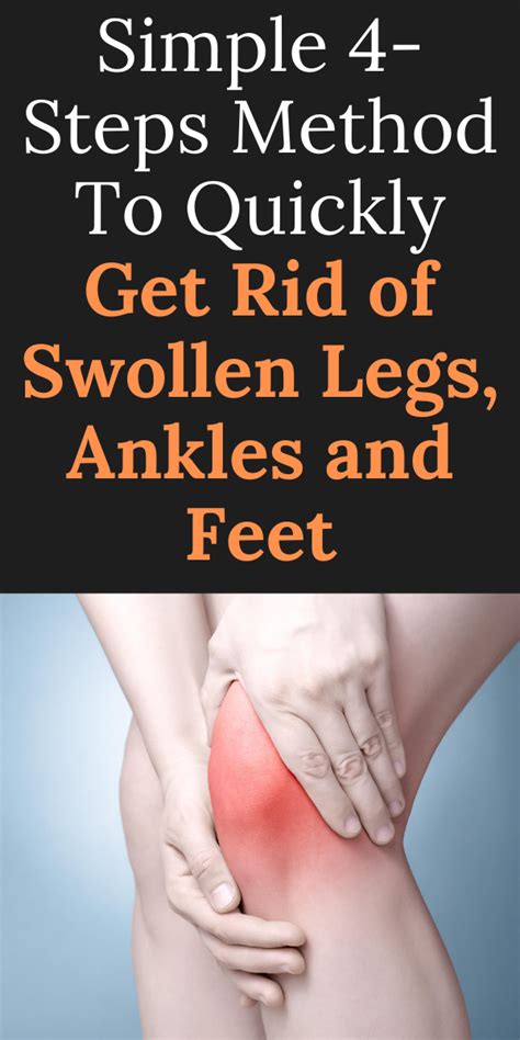 Simple 4 Step Method To Quickly Get Rid Of Swollen Legs Ankles And