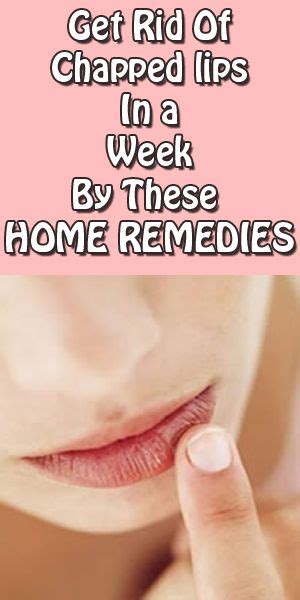 Top 5 Home Remedies For Chapped Lips With Images Cure For Chapped