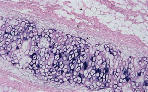 Hyaline Elastic And Fibro Cartilage