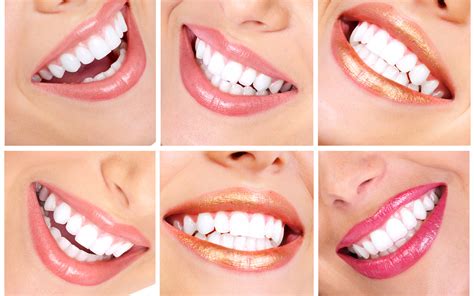 Smile Makeover Aesthetic Dental Zone
