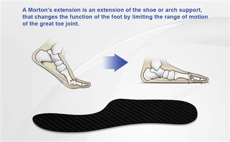 Carbon Fiber Insole Mortons Extension Orthotic Fakilo 1 Pair Rigid Foot Support