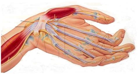 It is an acute and rapidly progressive inflammation of nerves that causes loss of sensation and muscle weakness. Syndrome De Guillain-Barré : Symptômes, causes, traitement ...