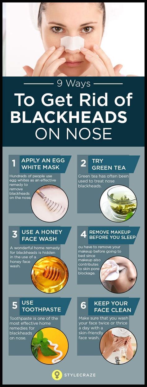 How To Remove Blackheads On Nose At Home Fast Get Rid Of Blackheads